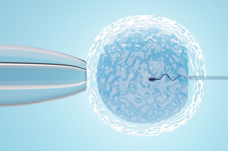 Fertility & IVF